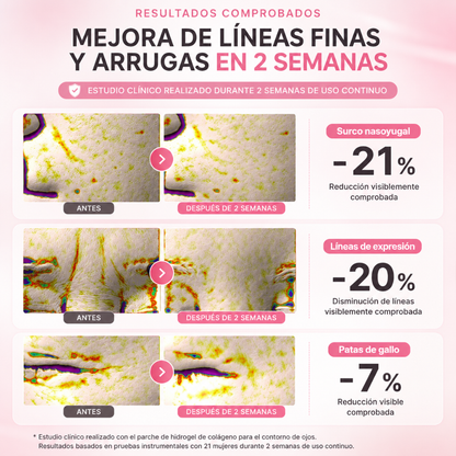 Parches de Colágeno para Ojos